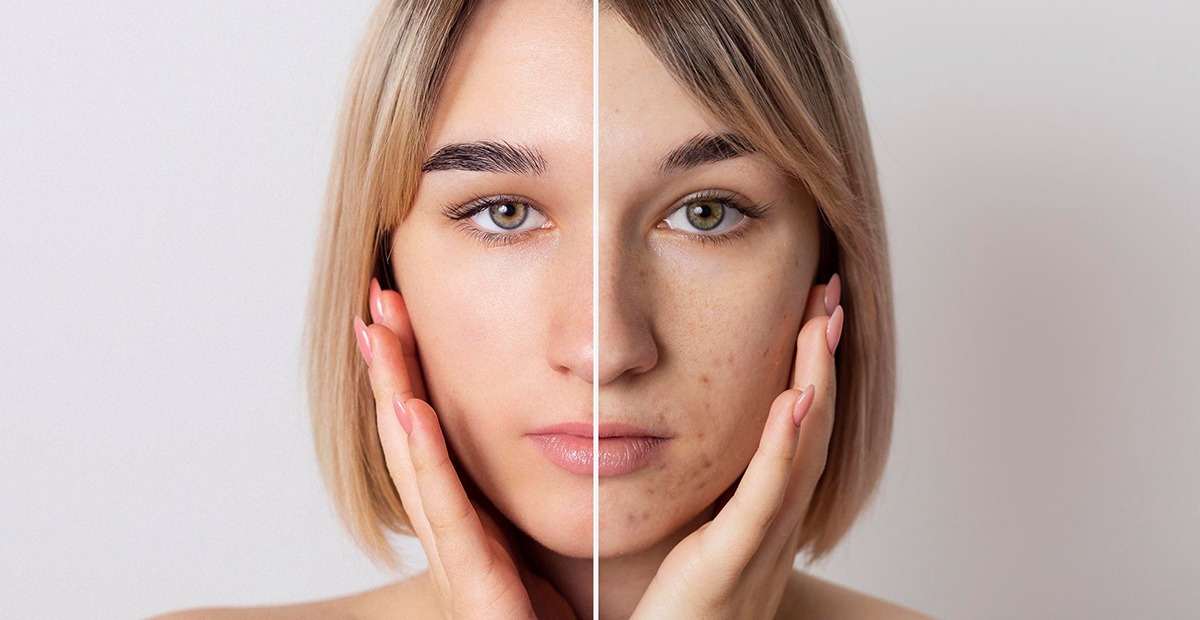 Wajah Kusam: Pengalaman, Penyebab, dan Cara Mengatasinya yang Sebenarnya Ampuh