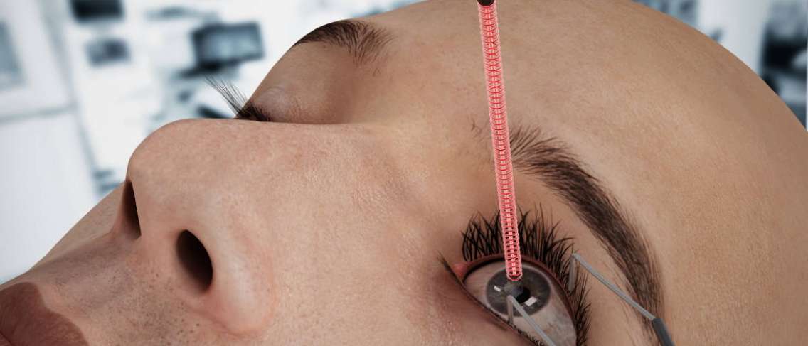 Memahami Teknologi Laser Mata dalam Kedokteran Modern