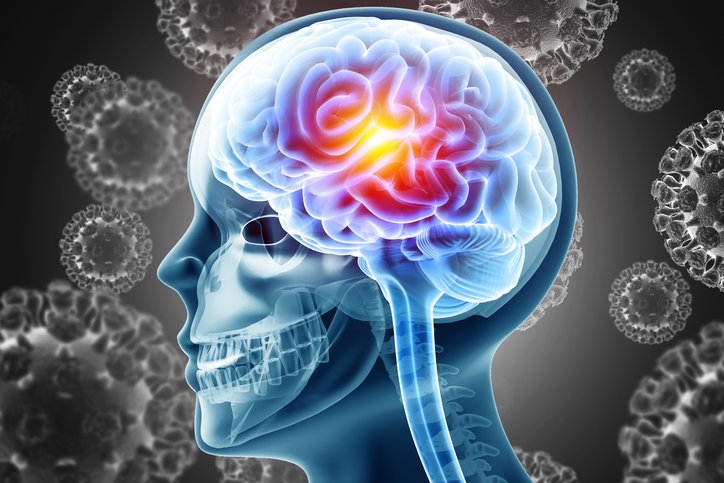 Langkah Diagnosis meningitis cerebral Medis di Rumah Sakit