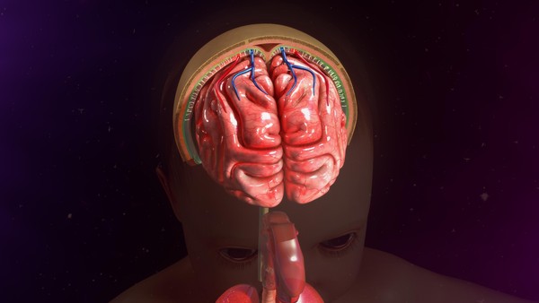 Memahami Penyebab di Balik Infeksi meningitis cerebral