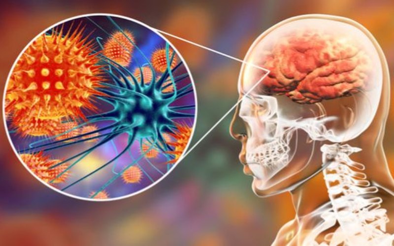 meningitis cerebral